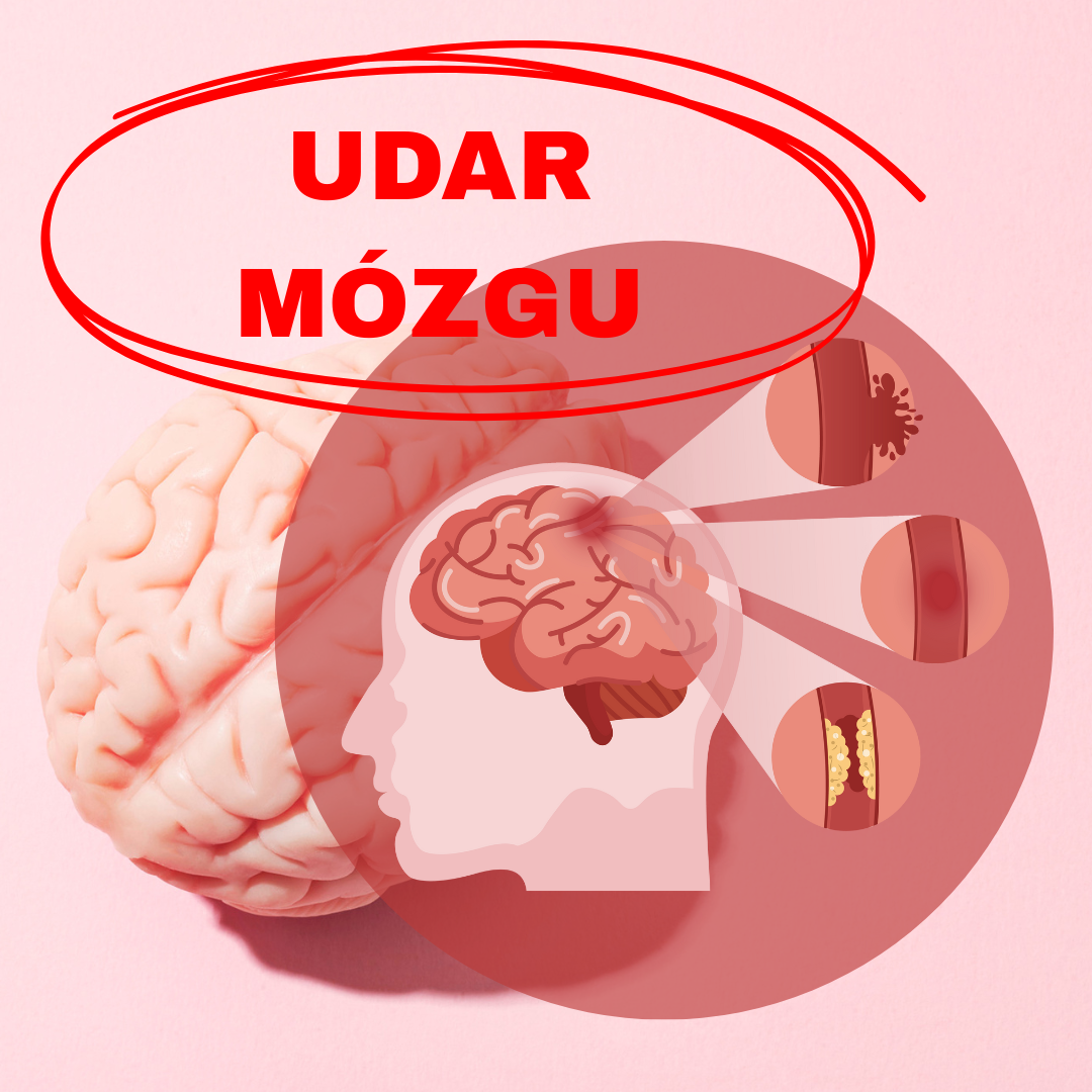 Proces pielęgnowania pacjenta po udarze mózgu