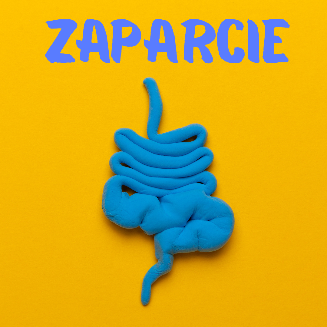 Proces pielęgnowania w zaparciach