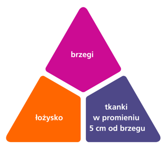 trójkąt rany